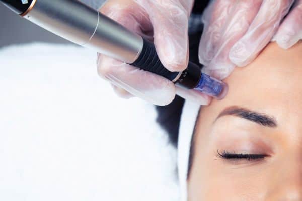 Explaining Total Skin Tightening Treatment and What to Expect 2 What Skin Concerns Can Total Skin Tightening Treatment Help With Rochester?